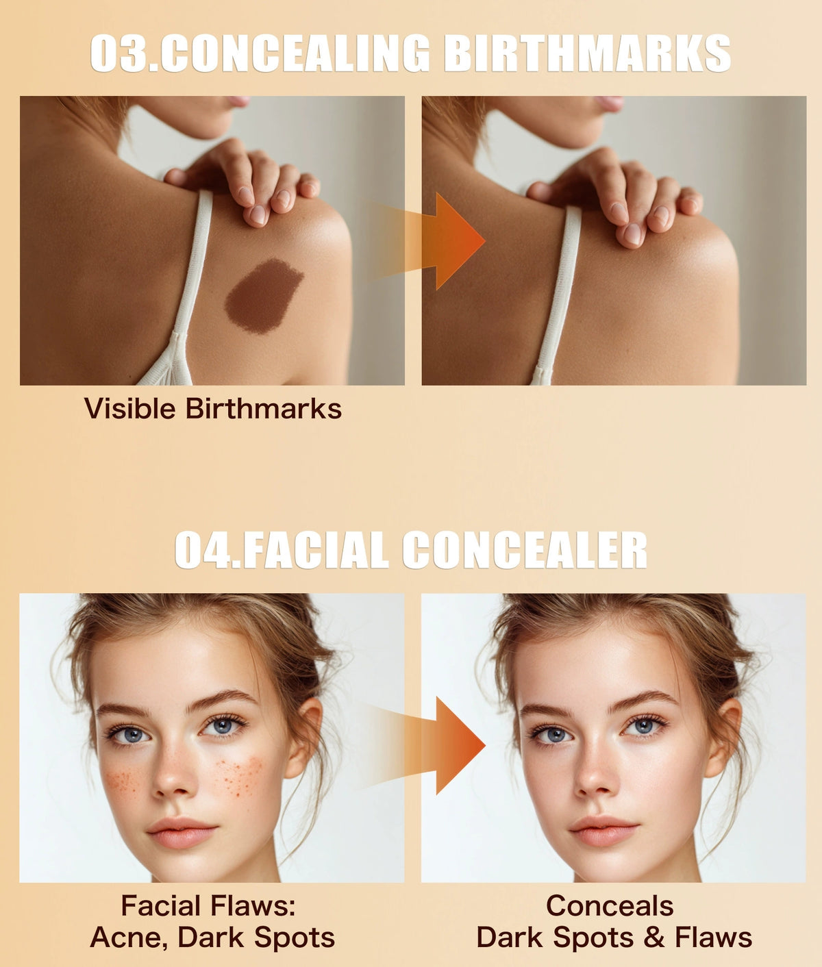 QIC concealer covers birthmarks, acne marks and facial flaws