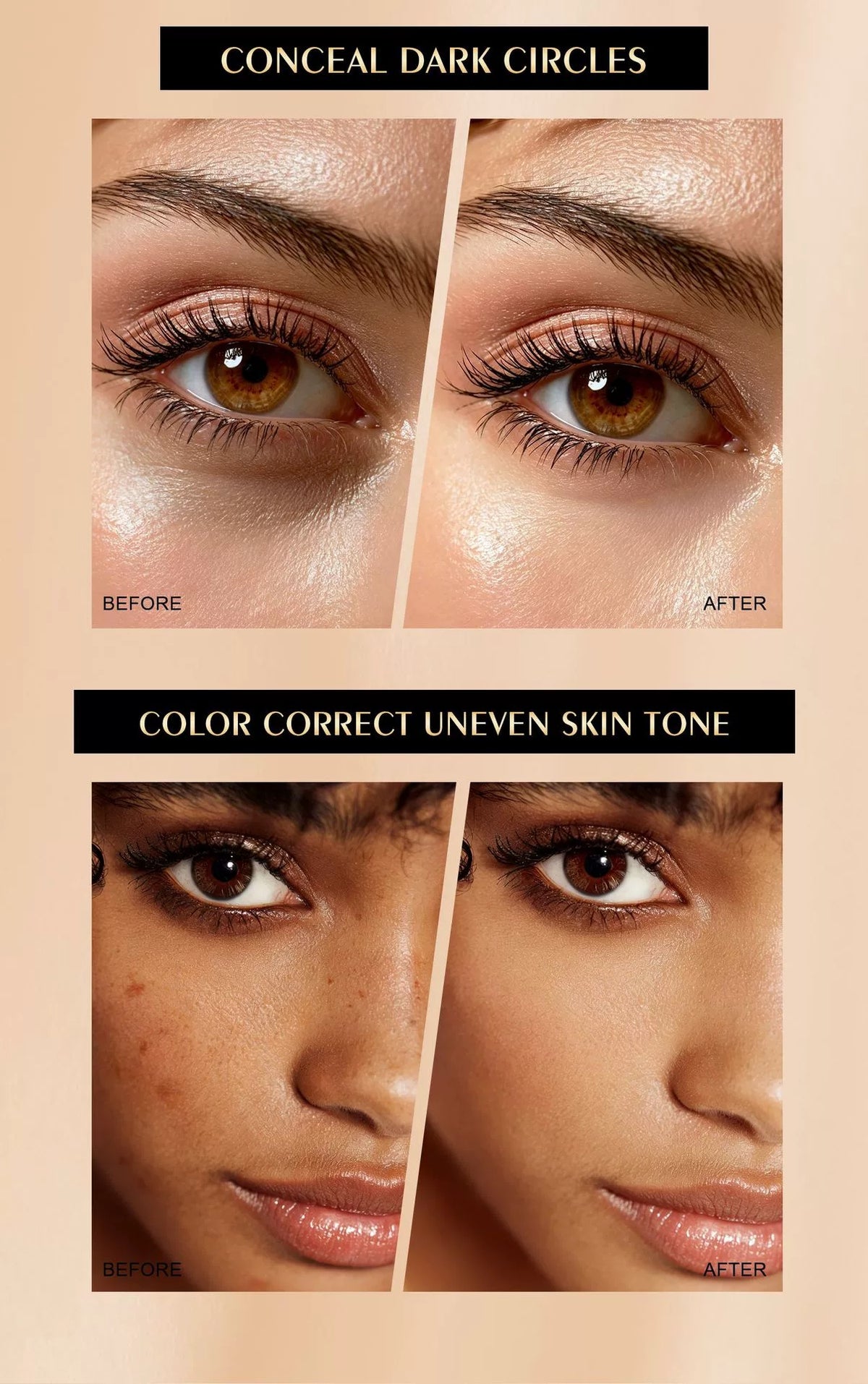 Before and after effect, QIC concealer covers tattoo, blemish and acne marks